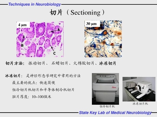 门诊切片保存多久 门诊的片子保存几年